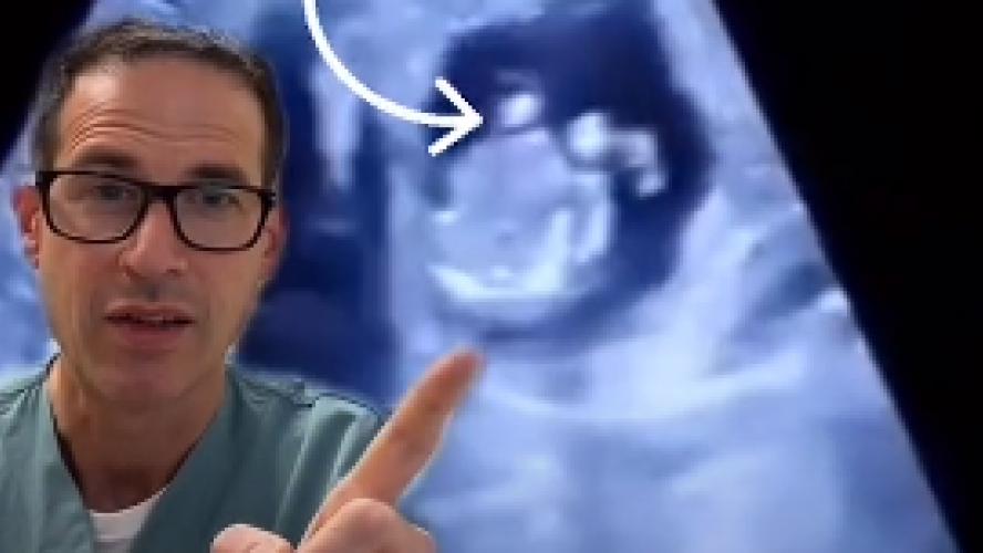 une échographie révèle un bébé logé dans le foie de sa maman