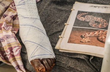 Togo : flou autour du décès d'un élève par morsure de serpent dans un champ d'enseignant